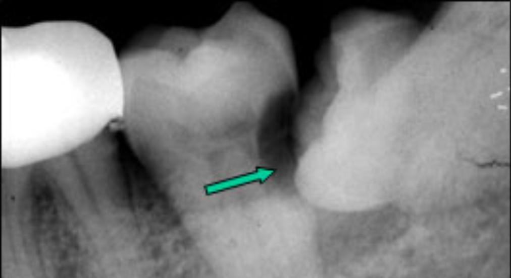 牙科诊所里你不知道的事,口腔医生提醒