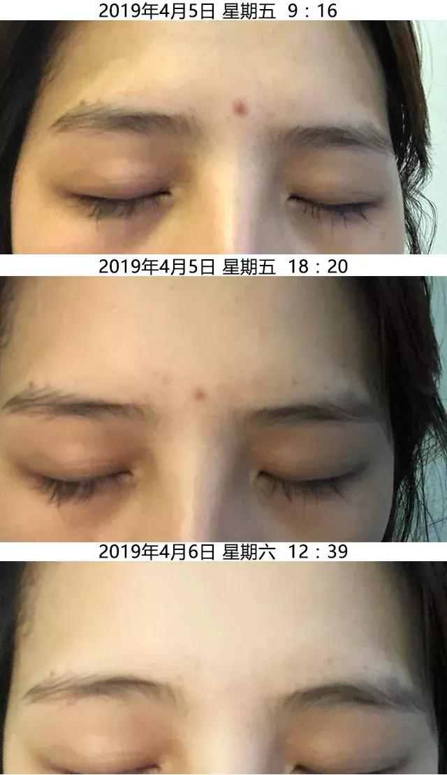 既能美白又抗老,既能美白又能抗衰老的护肤品