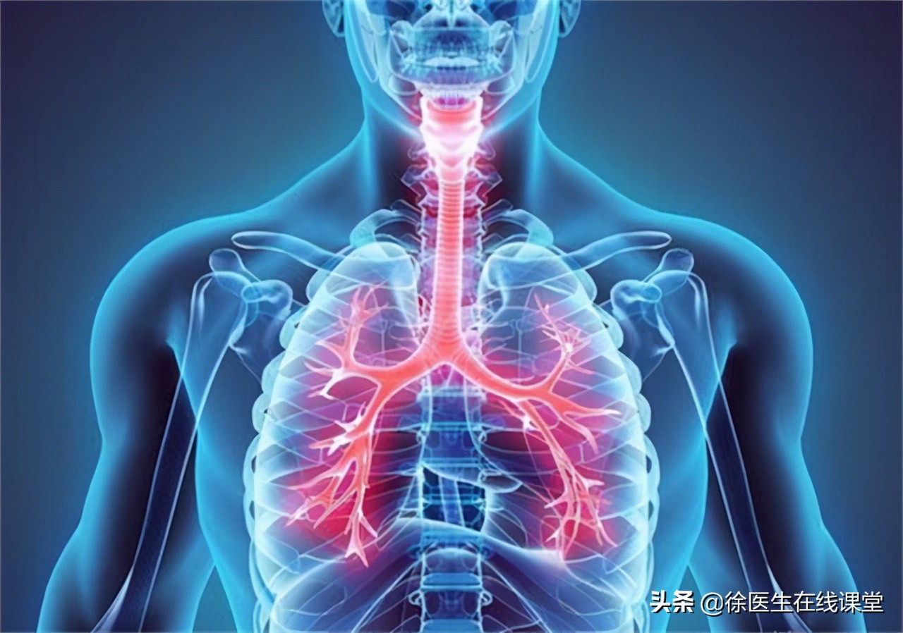 支气管哮喘治疗的5级阶梯治疗图,支气管哮喘分级和治疗