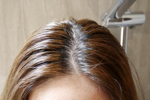 发质差头发稀疏，几个方法让毛囊多长头发