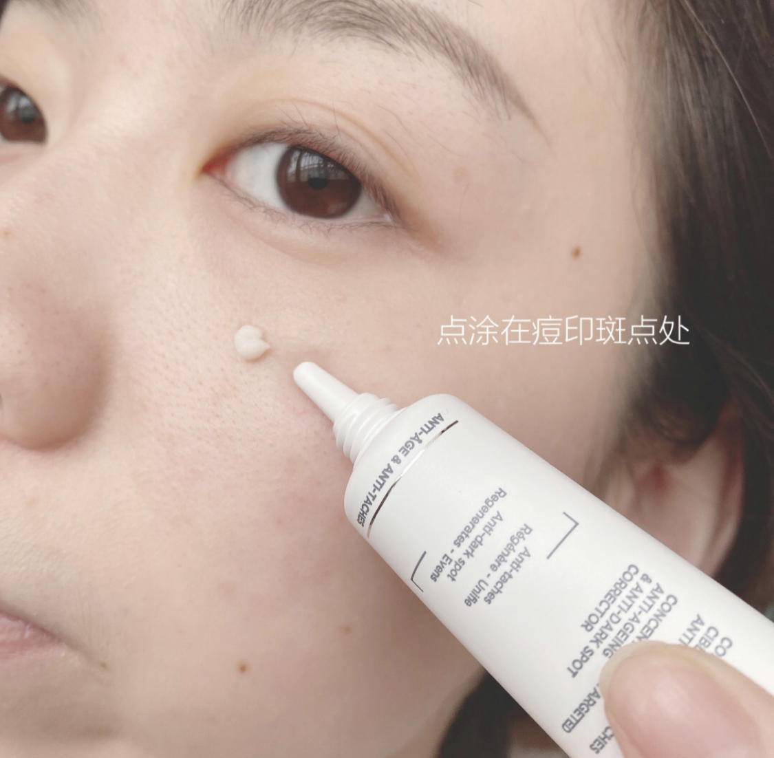 痘痘痘印的正确处理方法,痘痘留下的痘印应如何正确处理