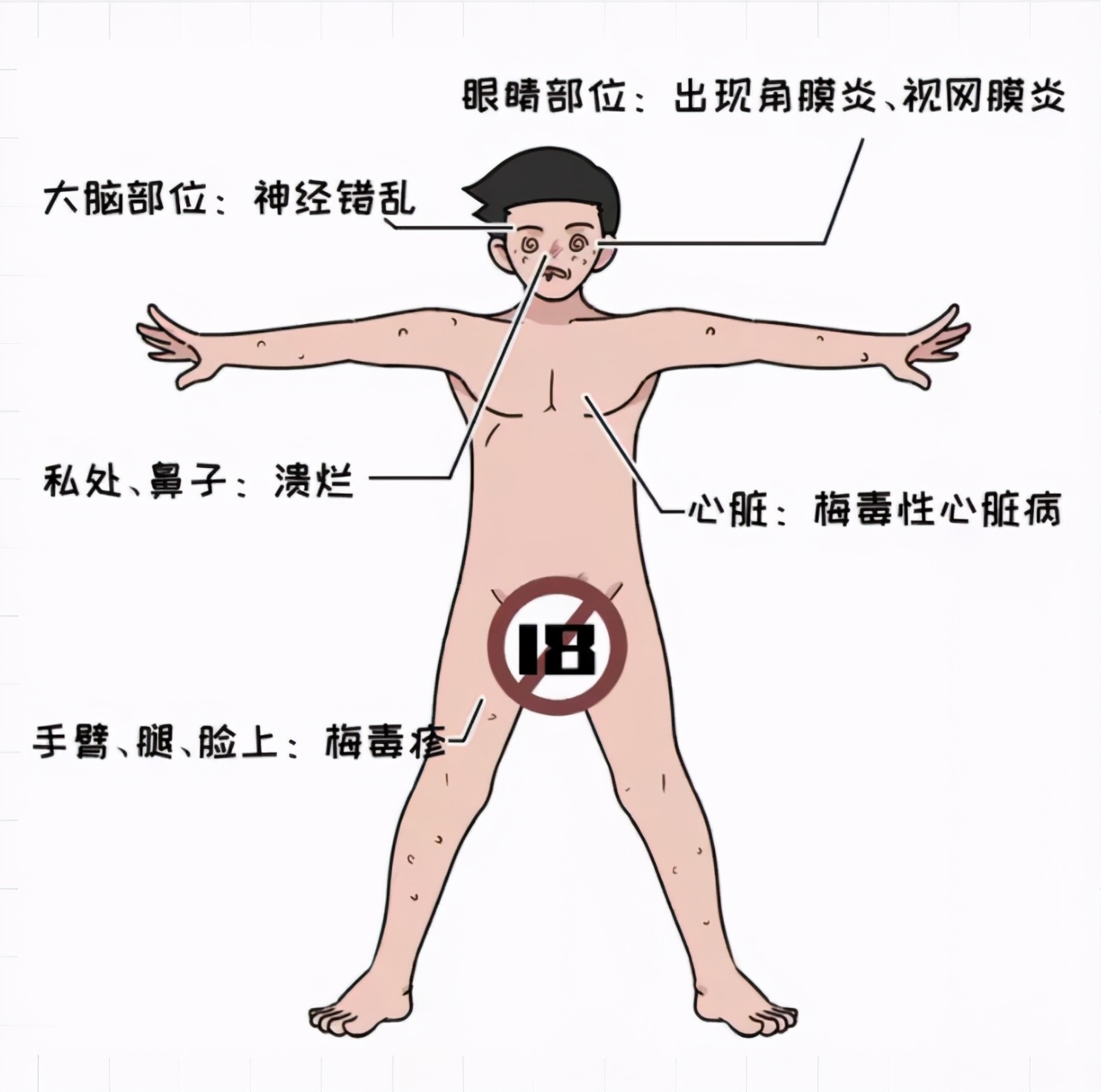 小伙被感染梅毒,感染梅毒胸口会不会不舒服