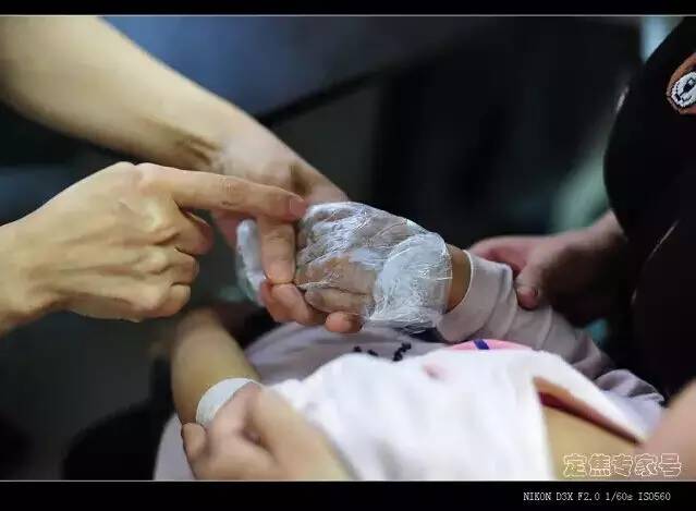 湿疹治不好会是心理原因吗,湿疹是湿还是干引起的