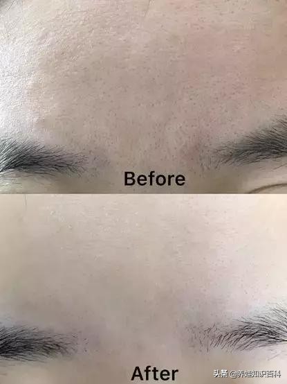 天天熬夜带娃瘦了,天天熬夜带娃也不见瘦