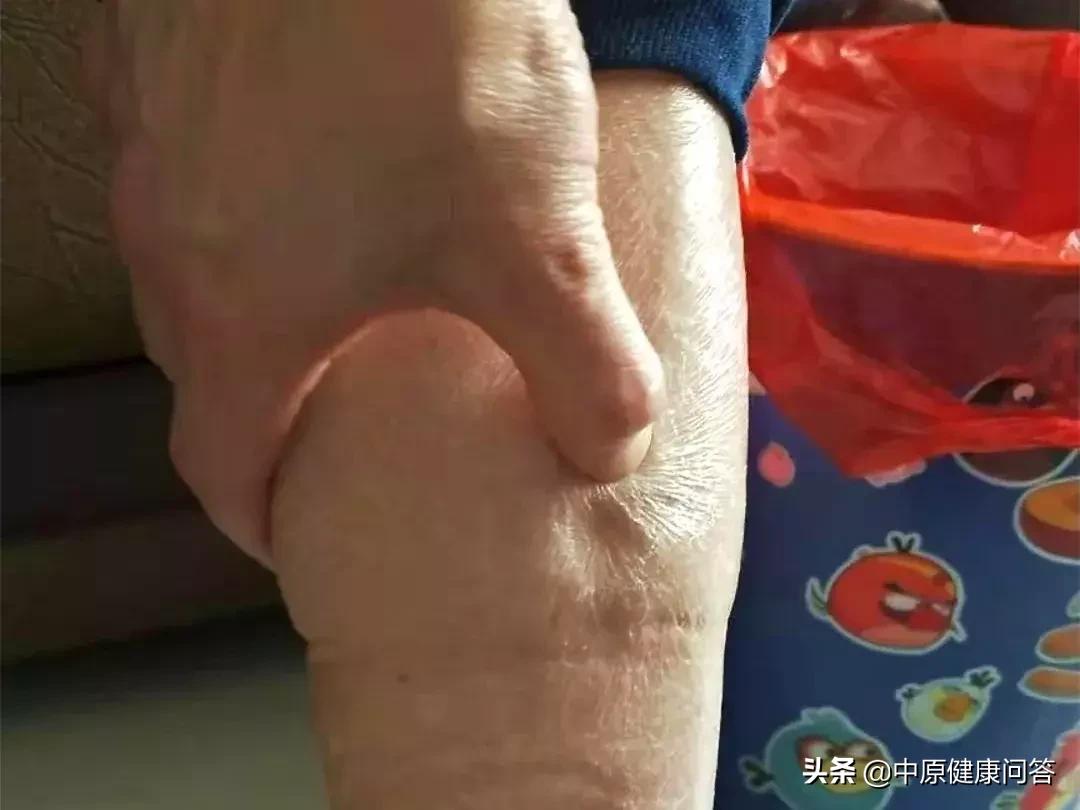 92岁老大爷家住5楼下不来，医生到家服务