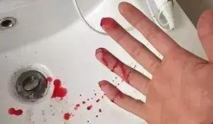 这辈子的澡都白洗了！日本336个增压细密喷射孔，洗澡比SPA还舒服