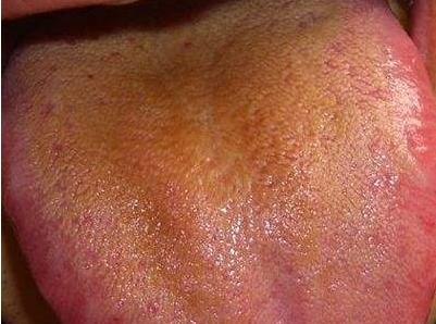关于舌苔知道身体健康的视频,舌苔是健康的晴雨表吗