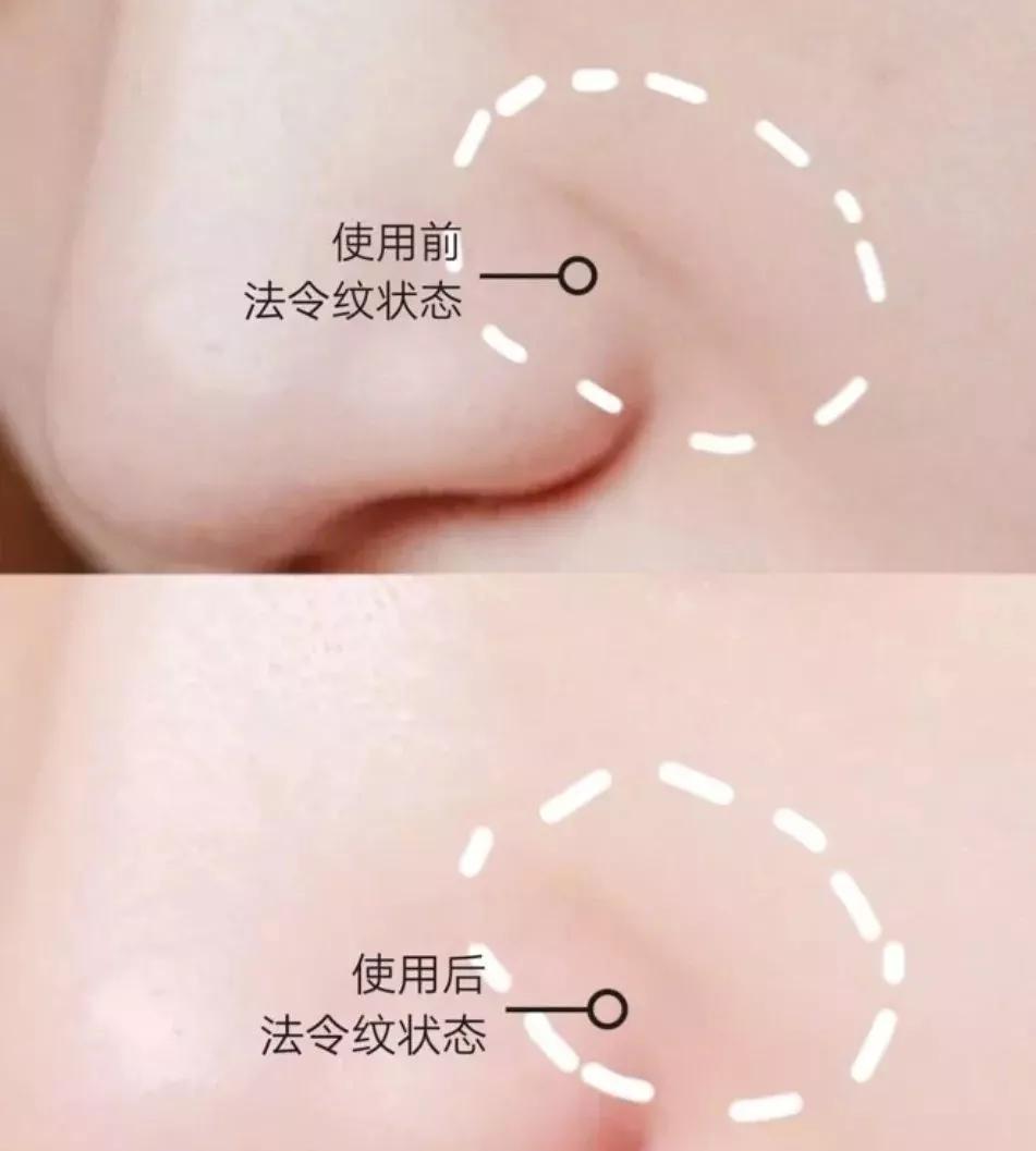 刘亦菲保养皮肤的方法,30岁皱纹多怎么修复