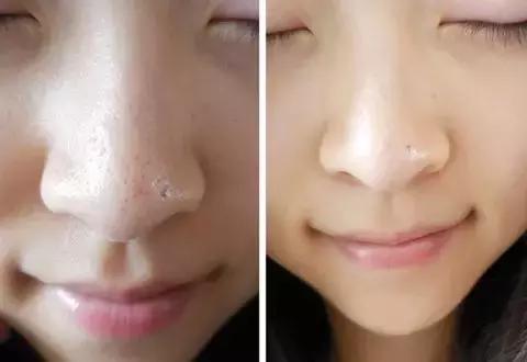 护肤太多的坏处有哪些呢,护肤越补越糟糕