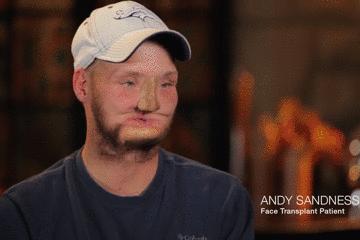 医生手术后最想做什么,医生做完手术以后会怎样