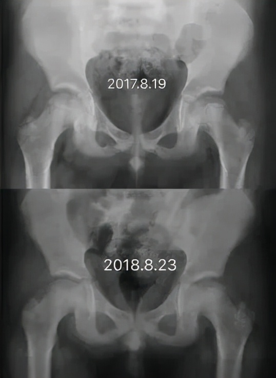 儿童医院儿童骨科,儿童骨科专家讲解