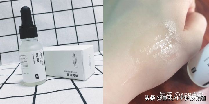 挤痘痘留下痘印多久会好,挤痘痘有哪些危害