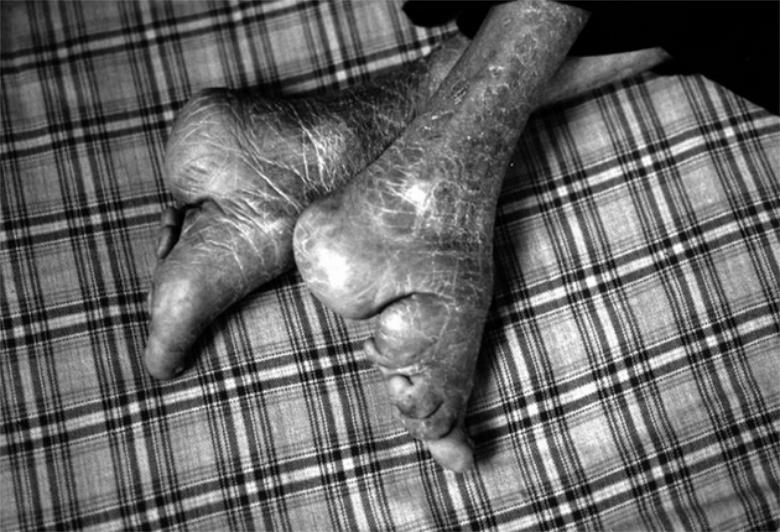 三分钟了解什么是真正的“三寸金莲”