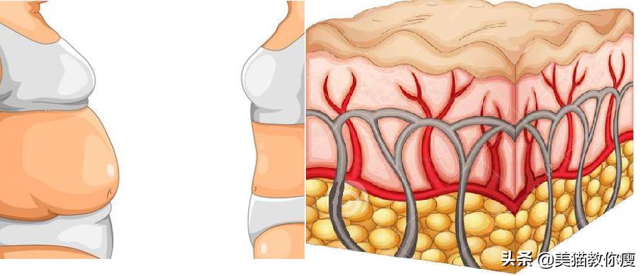 小学生肌肉腿怎么瘦成筷子腿,三天肌肉腿瘦成筷子腿