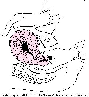 不管你是皇后,还是普通人的老婆,生孩子都存在产后出血的风险