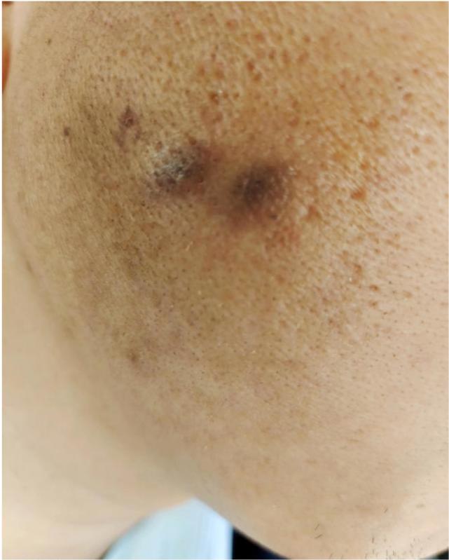 高管用烟头烫员工脸,员工之间职场霸凌行为该如何界定