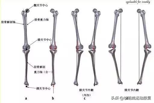 o型腿的自我鉴别及矫正方法,怎么知道o型腿是不是在慢慢变好