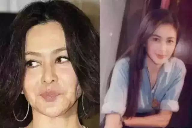 脸部凹陷怎么变饱满大小脸,脸颊凹陷怎么让脸胖起来