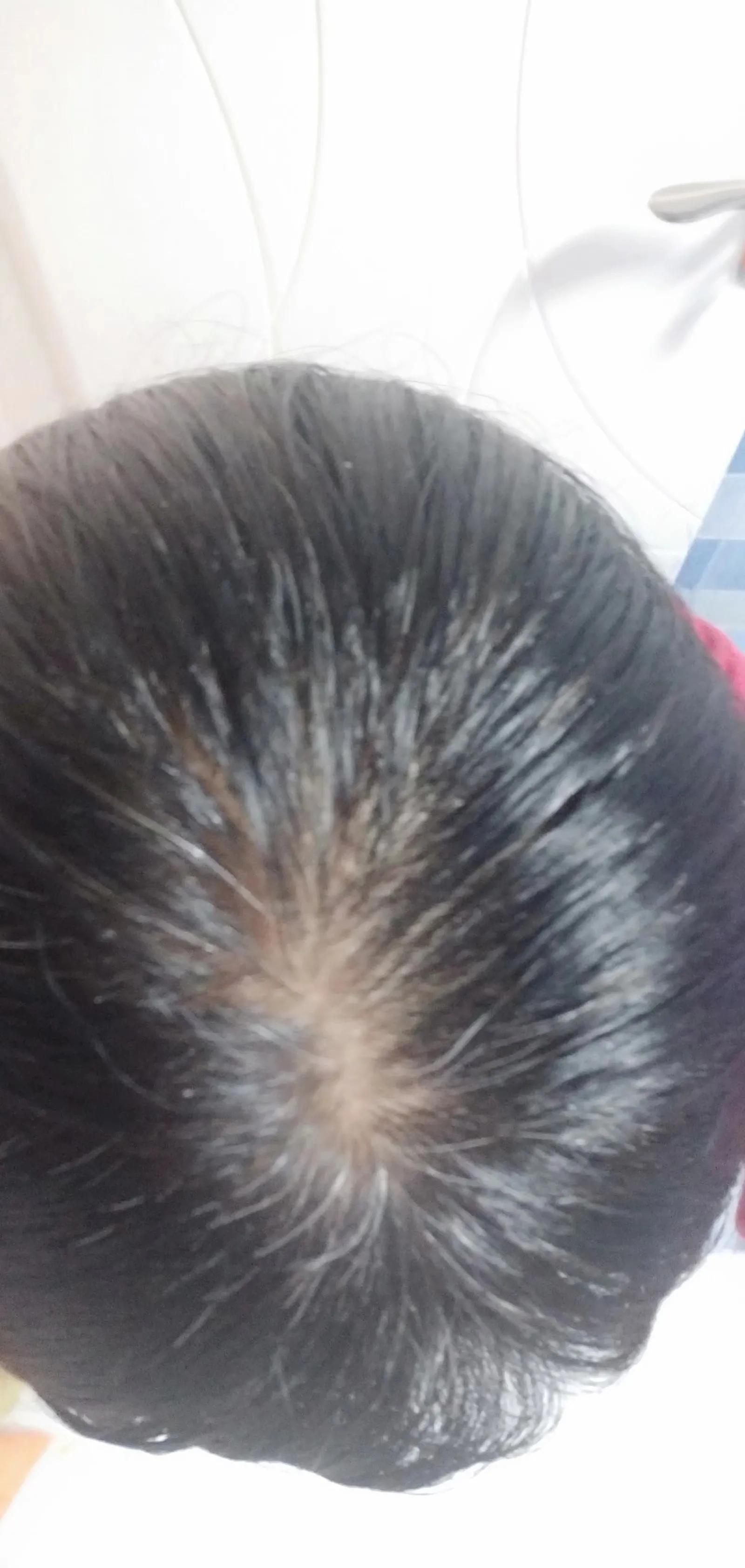 防脱发小妙招搞笑,防脱发生发的最好办法