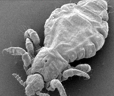 虱子存在的环境是哪样的,为啥阴虱比普通虱子难以去除