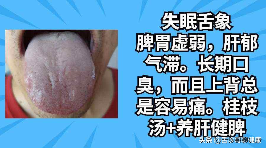 抖音舌诊哥,舌诊歌舌象分析和感悟