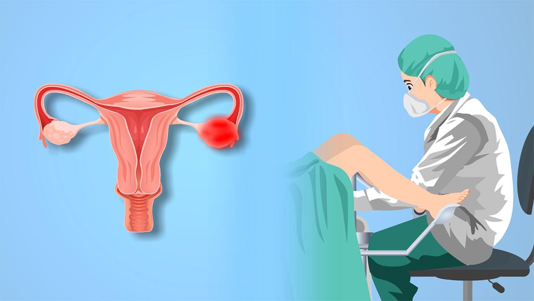 腹痛白带异常,卵巢炎白带能查出吗