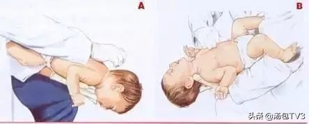 异物卡喉海姆立克急救法原理,异物卡喉海姆立克急救自救法