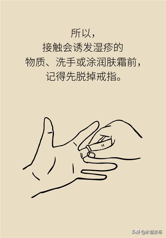 湿疹膏有哪些治疗效果好的,湿疹膏可以治愈吗