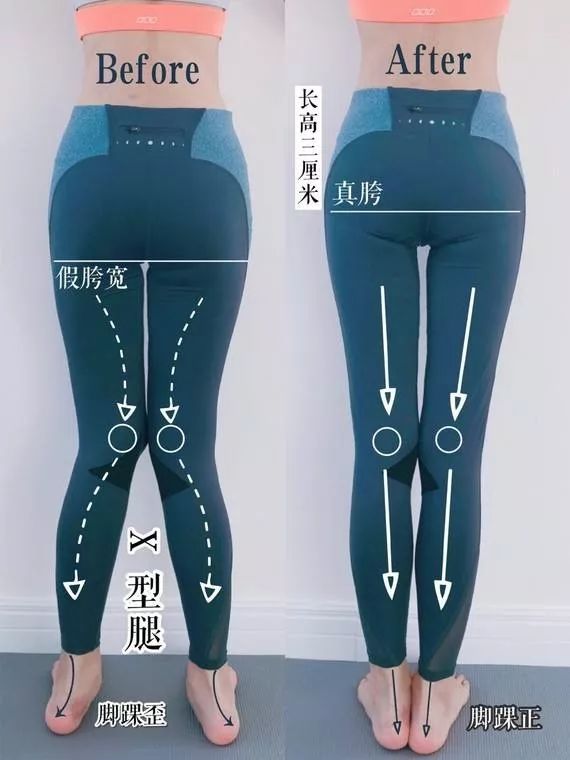 腿粗腿型不好如何改善,腿短而且大腿粗适合穿什么裤子