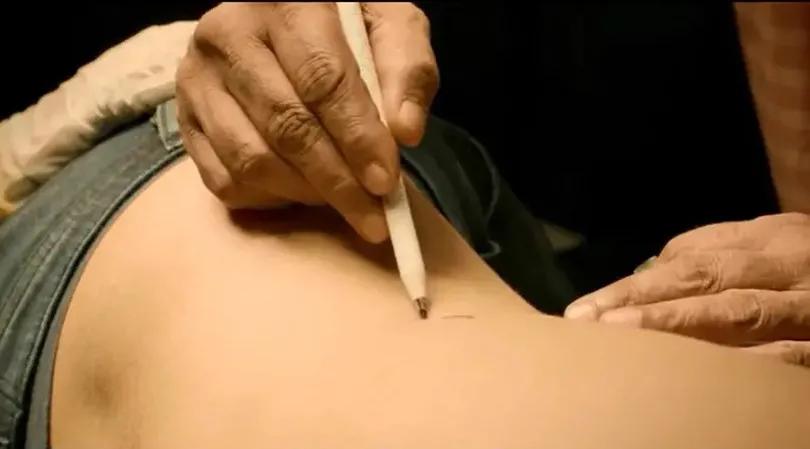 卖肾工厂，在这里|地球知识局