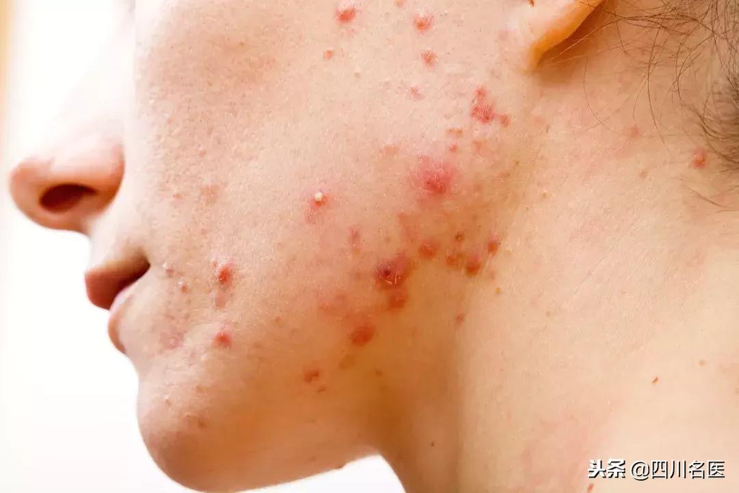 有趣的面膜能让你一敷就上瘾,有效果的面膜越敷越上瘾