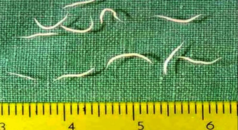 现在小学生要打虫吗,给小孩打虫的季节