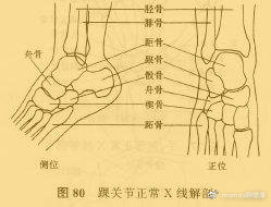 跳绳后膝盖后面的一整根筋疼,跳绳膝盖疼痛吃什么药