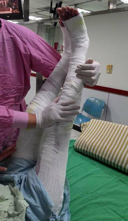 24岁正妹护理师因毁容曾想自杀，但现在立志重生回归