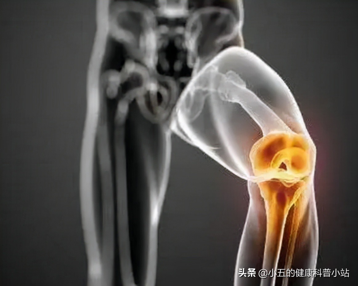 膝关节咔咔作响怎么回事,膝盖痛髌骨软化症怎么治疗