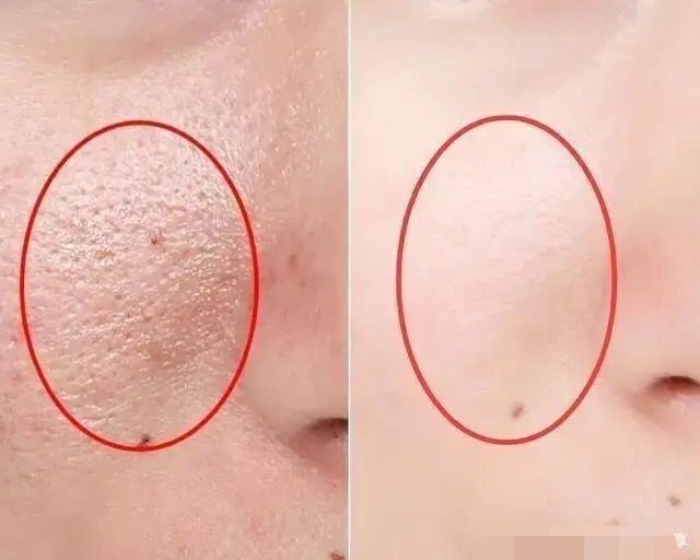 美容黑幕,美容仪内幕大揭秘