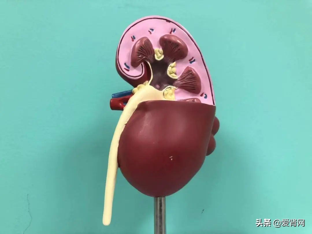 尿毒症可怕还是切了一个肾可怕,尿毒症对人体的危害