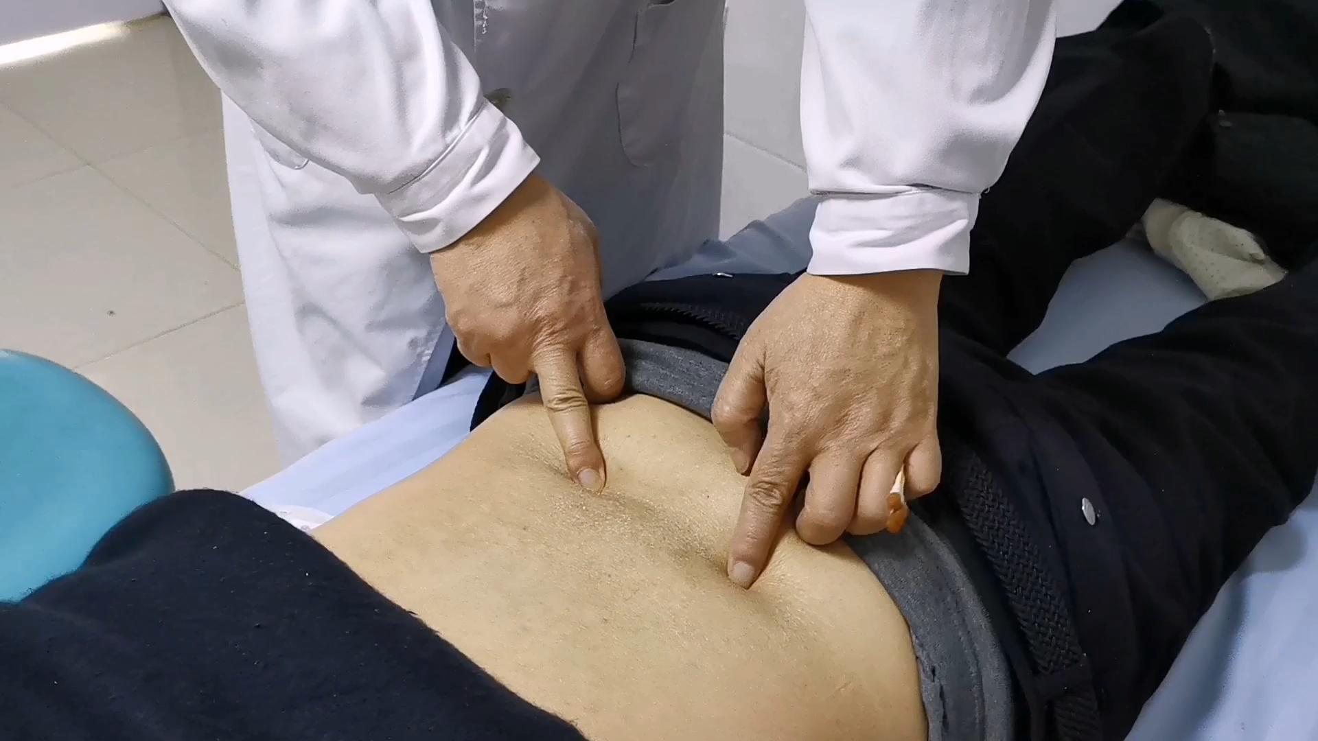 针灸治疗腰突症病例分享,针灸治疗腰突腿痛一般几天有效果