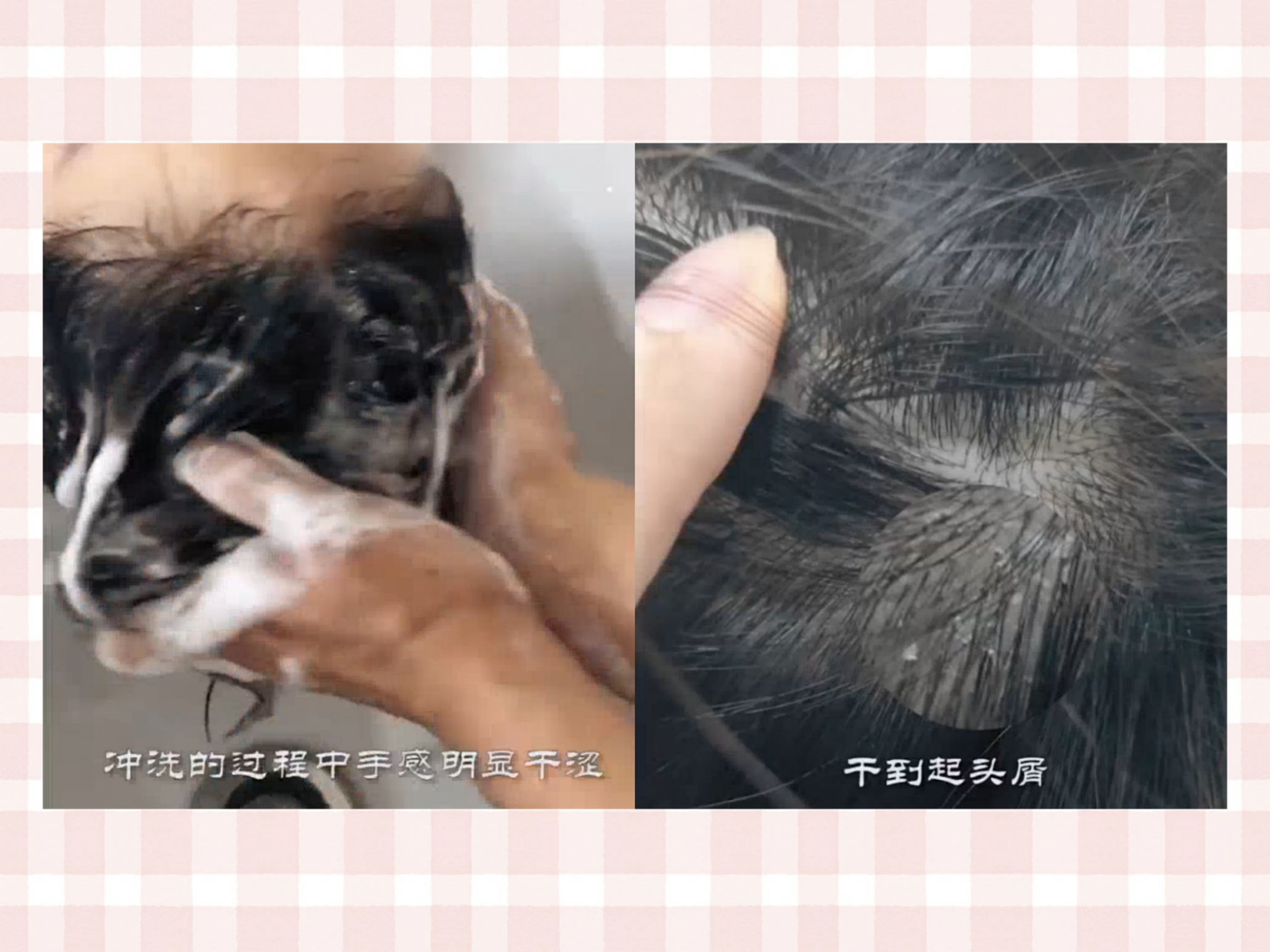 蓝吕和绿吕洗发水的区别,绿吕洗发水去屑效果怎么样