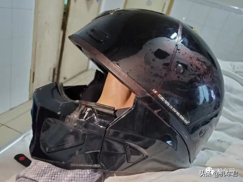 鼻梁被撞断了,时速60公里的鼻梁被切掉