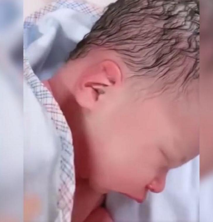 产妇用力不当胎儿头型会变吗,产妇用力不当导致胎儿头部畸形