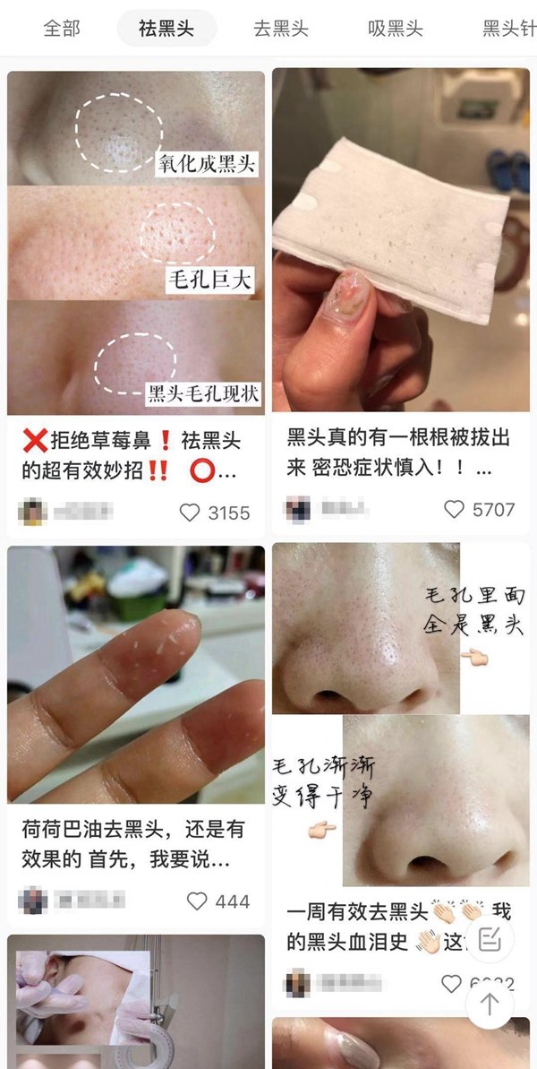 挤鼻子上的黑头留下的坑怎么去除,挤鼻子上黑头挤出像毛一样东西