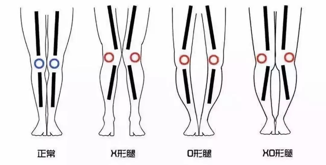 上身很瘦下身胯部宽,上身很瘦而下身正常