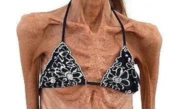 人民日报女性减肥,人民日报最新减肥药