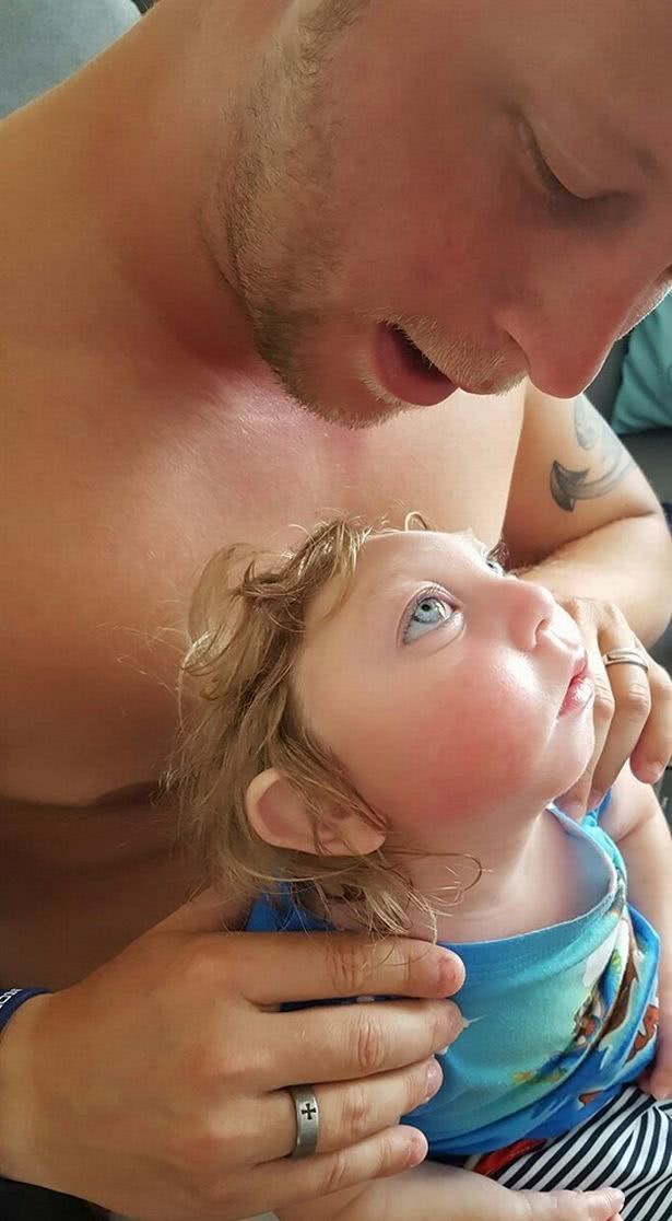 男孩出生时头骨缺陷能活多久,出生时头骨缺陷的男孩