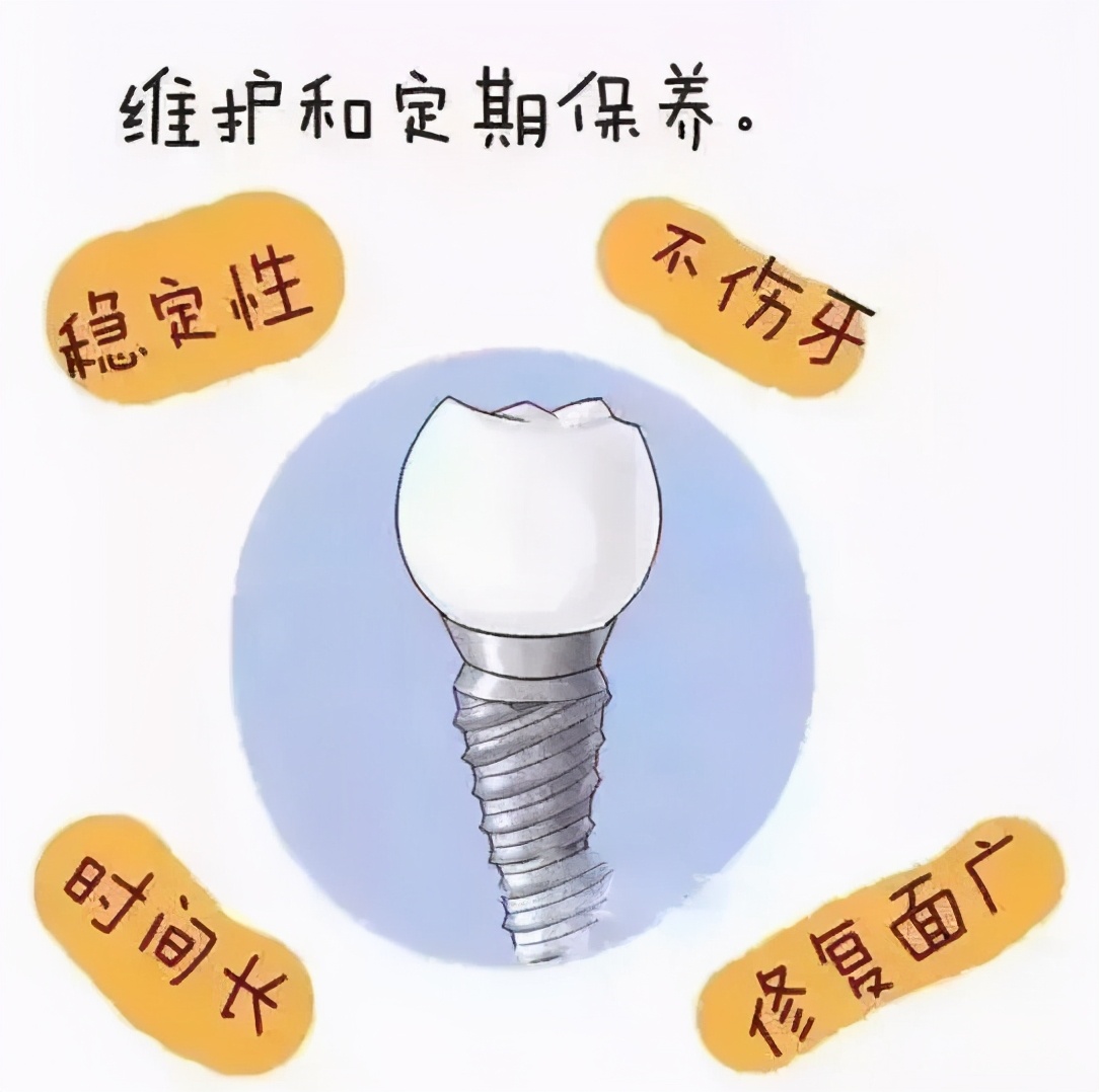 种植牙是不是要坏牙全拔,1颗牙坏了做牙套好还是种植牙好