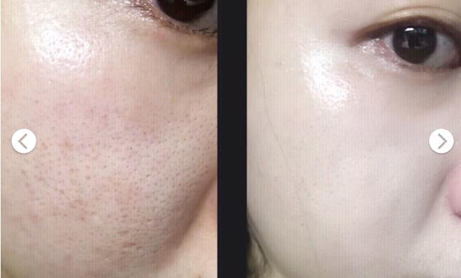 不老仙妻用什么护肤品,去黑头卸妆膏