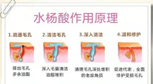 深圳治痘痘皮肤科哪个医院好啊,去皮肤科看痘痘好不好