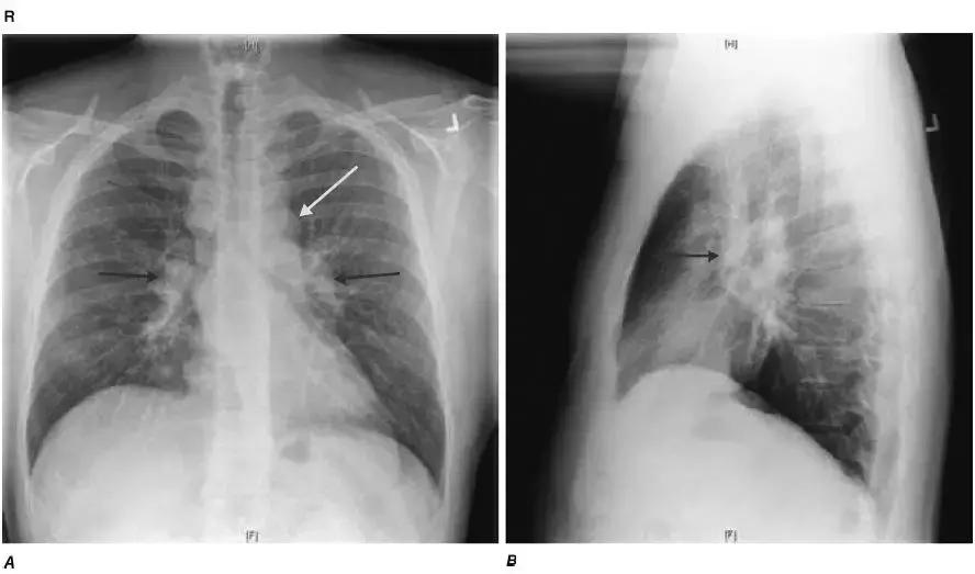 胸部影像解剖图谱书,胸部断层图谱