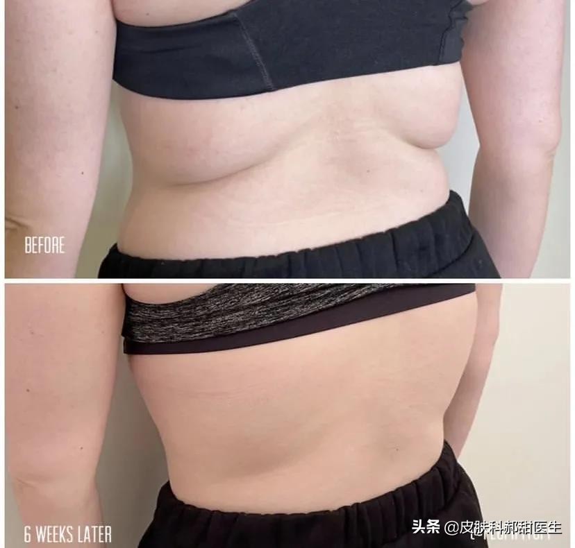 漾格医美皮秒怎么样,漾格医美场景视频